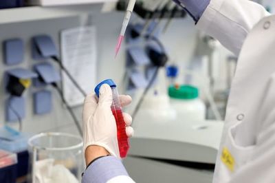 OMS ve factible una vacuna contra COVID-19 para principios de 2021 - Mundo - ABC Color