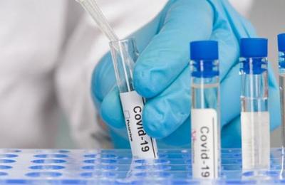 Científicos argentinos desarrollaron un suero de caballos que neutraliza el coronavirus - SNT