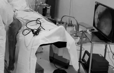 Recuperan rodilla de paciente con innovador procedimiento en Ayolas