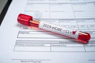 Brasil superó el millón de casos positivos de coronavirus » Ñanduti