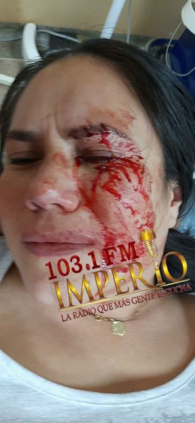 Asaltante cortó el rostro de una mujer en intento de robo de motocicleta
