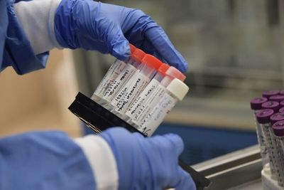 Estudios científicos dicen que la inmunidad no tendría efecto a largo plazo - Ciencia - ABC Color