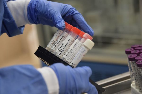 Estudios científicos dicen que la inmunidad no tendría efecto a largo plazo - Ciencia - ABC Color