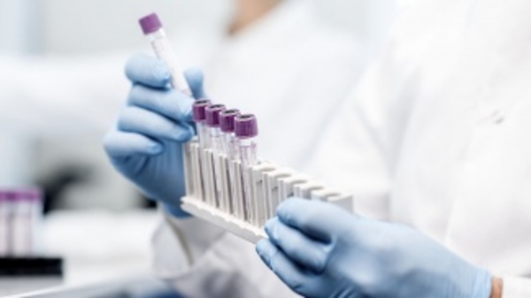 Científicos rusos crean un test de cáncer de próstata similar a la prueba de embarazo » Ñanduti