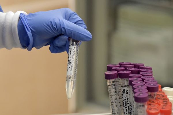 IPS: Médicos van a cuarentena tras operar a una paciente con COVID-19 - Nacionales - ABC Color
