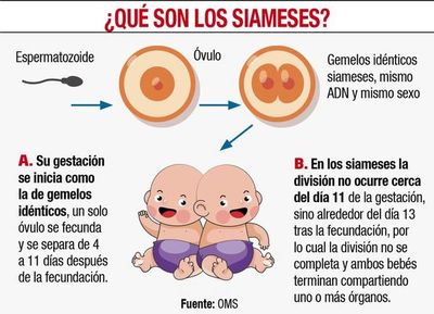 Aún no hay fecha para separar a los siameses - Locales - ABC Color