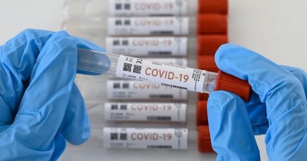 Registran 30 nuevos casos de coronavirus
