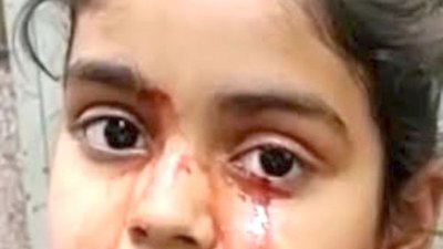 Una nenita llora sangre y nadie sabe porqué | Crónica