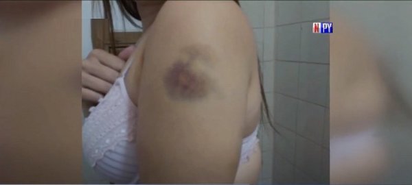 Mujer denuncia a su expareja por violencia | Noticias Paraguay
