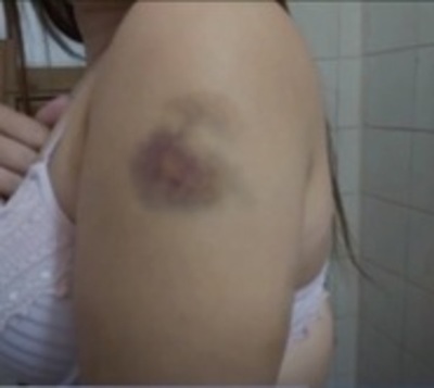 Mujer denuncia a su expareja por violencia - Paraguay.com