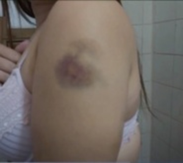 Mujer denuncia a su expareja por violencia - Paraguay.com
