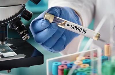 Agencia Europea del Medicamento recomienda la venta de fármaco para tratar el Covid-19 - SNT