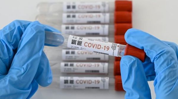 Coronavirus: número de casos en el mundo supera los 10 millones » Ñanduti