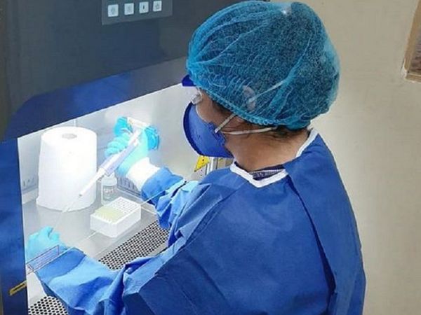 Salud monitorea a 47 contactos del último paciente fallecido con Covid-19