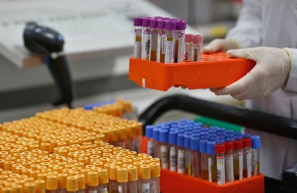 Fármaco contra VIH no reduce mortalidad en pacientes de covid-19 - Ciencia - ABC Color