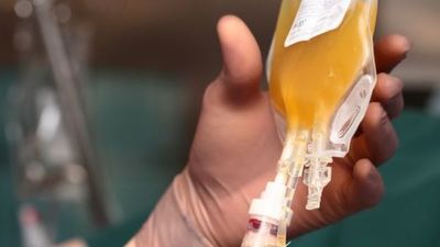 Medicina-UNA realizará investigación con plasma para tratar pacientes con Covid-19