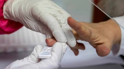 HOY / ¿Falsa publicidad? Cuidado con los tests rápidos de COVID-19, advierte Sequera