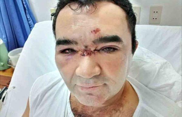 Denuncian violencia policial durante una intervención en el Chaco - Nacionales - ABC Color