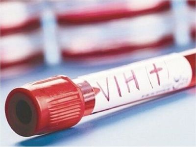 Desarrollan un nuevo tratamiento de acción prolongada para el VIH