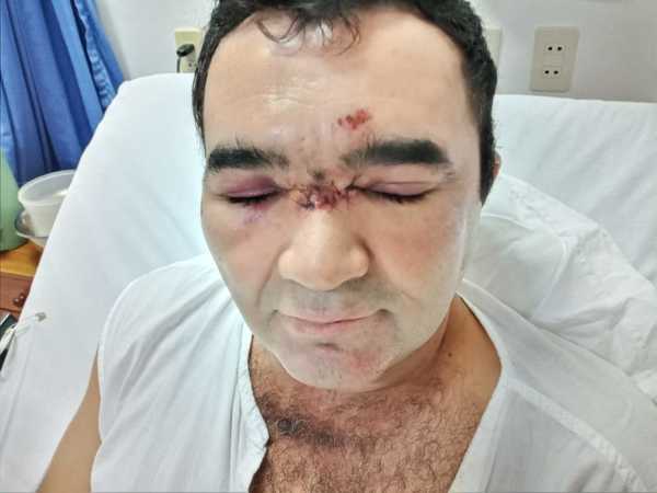 Denuncian a agentes policiales por supuesto uso excesivo de la fuerza en Filadelfia