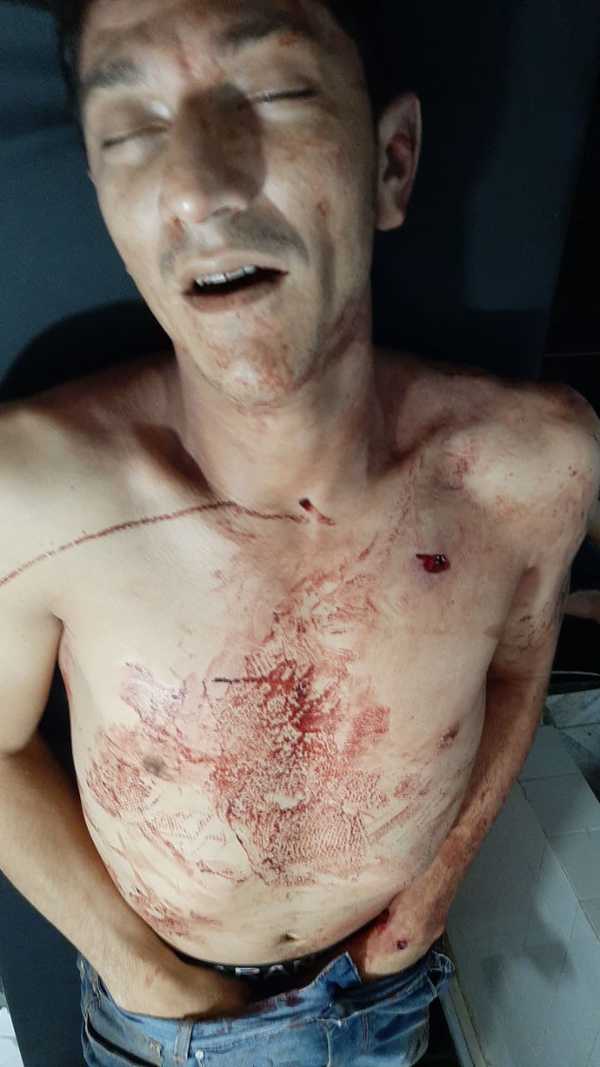Delincuente muere al ser herido por un policía durante violento asalto