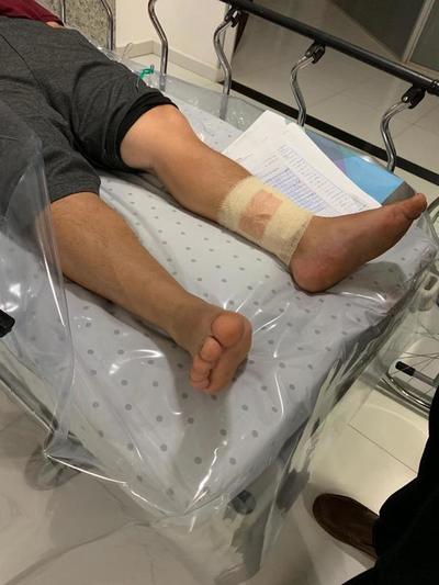 Político colorado herido por MOTOCHORROS en Franco