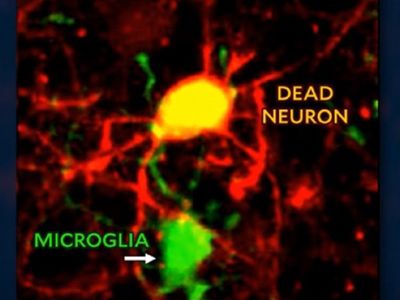 Captan en video cómo el cerebro elimina las neuronas muertas