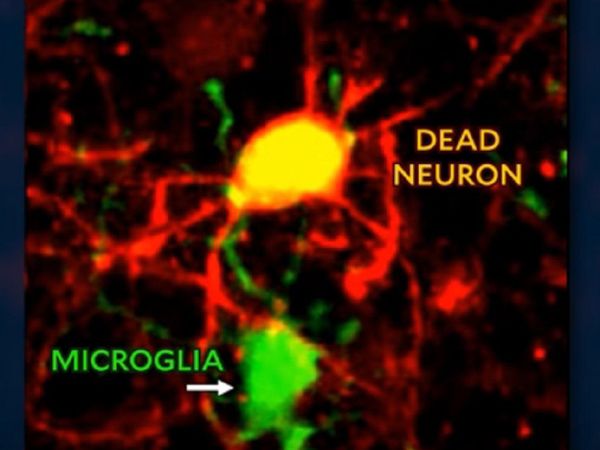 Captan en video cómo el cerebro elimina las neuronas muertas