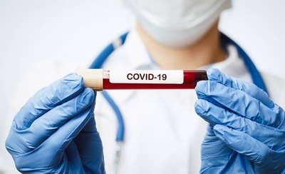 HOY / CONACYT adjudica fondos para investigar uso de plasma en pacientes con COVID-19