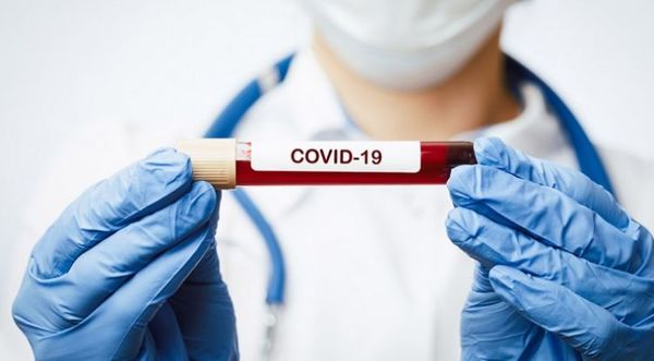 CONACYT adjudica fondos para investigar uso de plasma en pacientes con COVID-19