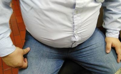 COVID-19: Pacientes con obesidad pueden tener el peor pronóstico e instan a prevención y correcta alimentación - Contacto Ciudadano - ABC Color