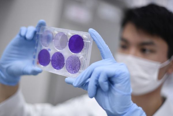 Brasil, terreno de ensayo para vacunas contra coronavirus - Mundo - ABC Color