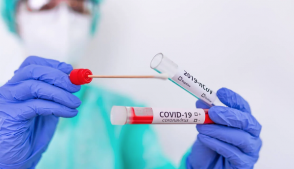 HOY / Proponen cambiar enfoque para hacer tests de COVID-19 y priorizar a la población vulnerable