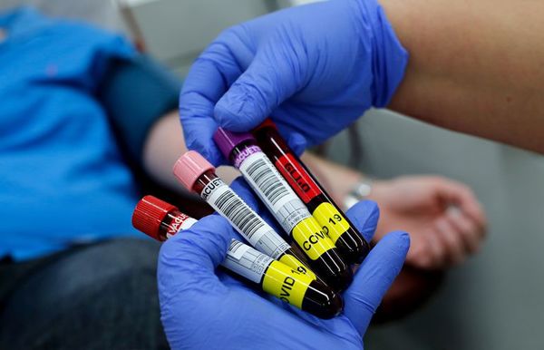 Aprueban financiación para proyecto que evaluará resultados del uso de plasma para el tratamiento del COVID-19 - Ciencia - ABC Color