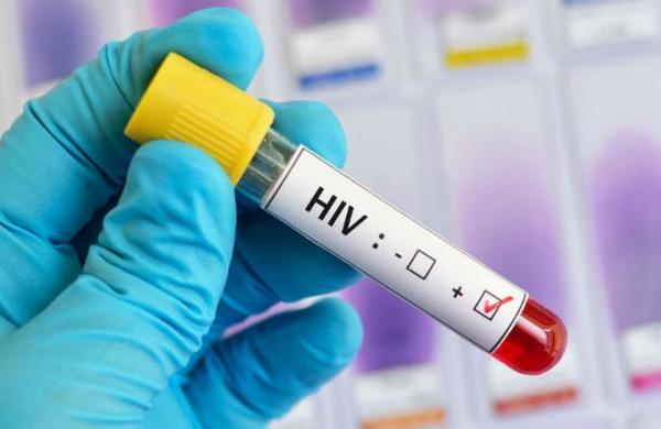 Más de 70 países podrían quedar sin fármacos contra el VIH - SNT