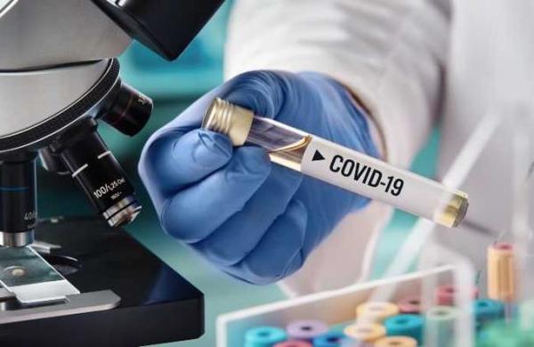 Estudio sugiere que el coronavirus podría causar problemas cerebrales - SNT