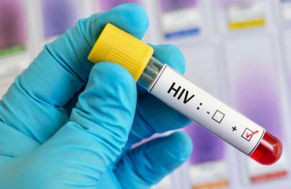 Más de 70 países podrían quedar sin fármacos contra el VIH - C9N