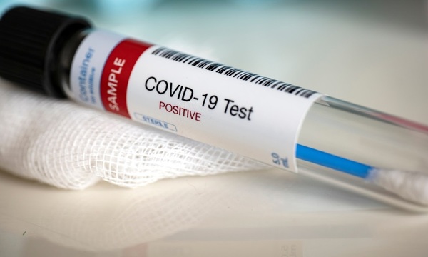 COVID19: Salud informa de 52 nuevos casos positivos y 13 nuevos sin nexos