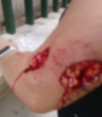 Denuncian que un perro atacó bravamente a una señora » Ñanduti