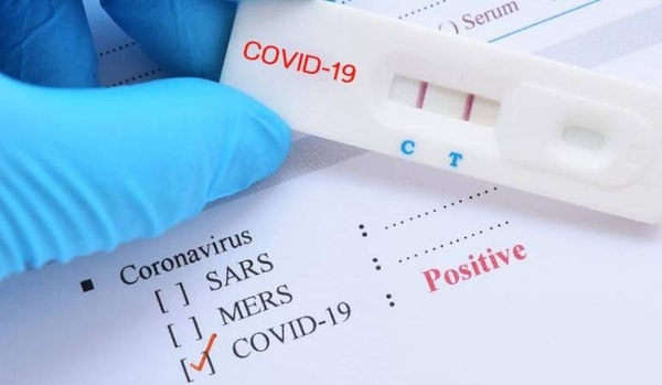 HOY / Confirman 98 nuevos casos de COVID-19, la mayoría contactos: suman otros 17 sin nexo