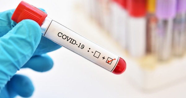 Coronavirus en San Lorenzo: 64 confirmados y 36 activos