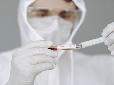 Salud reporta 84 nuevos casos positivos de Covid-19 y un fallecido