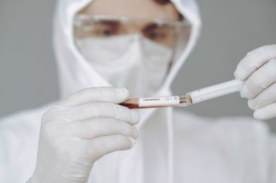 Salud reporta 84 nuevos casos positivos de Covid-19 y un fallecido