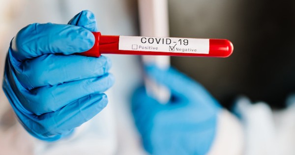 Diputado finalmente da negativo al test de COVID-19, según Salud