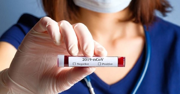 Confirman un nuevo fallecido y 128 casos de coronavirus