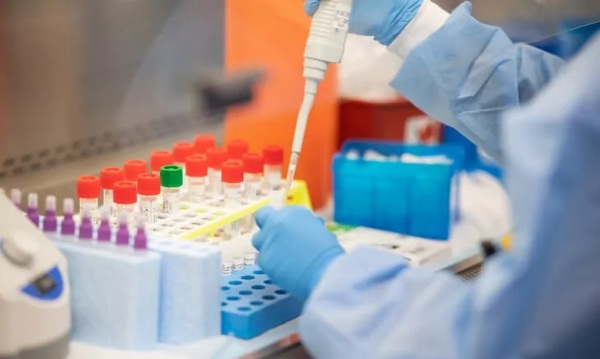 Anuncian que 350 empleados de Supermercado serán sometidos a prueba de Coronavirus en Luque