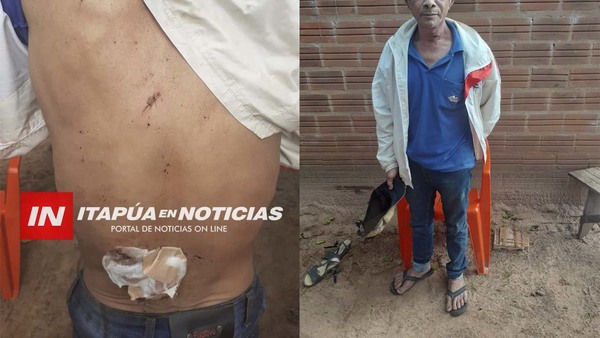 FUE ACUCHILLADO POR SU SOBRINO PERO NO LO QUISO DENUNCIAR