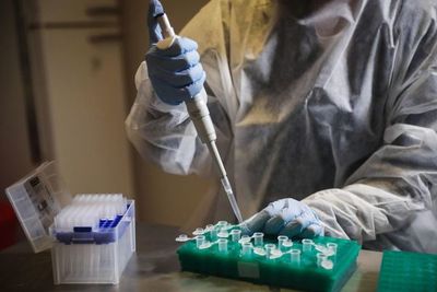 Guinea Ecuatorial dejó de informar de casos de COVID-19 “para no alarmar” - Mundo - ABC Color