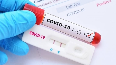HOY / Confirman 124 nuevos casos de COVID-19: contactos encabezan la lista y hay otros 33 sin nexo