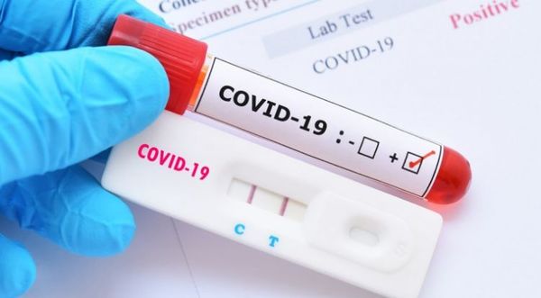 Confirman 124 nuevos casos de COVID-19: contactos encabezan la lista y hay otros 33 sin nexo